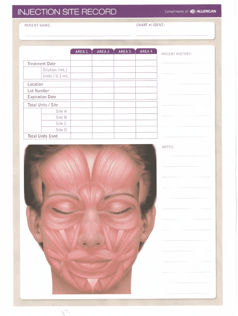 Printable Botox Face Chart Free Printable Templates