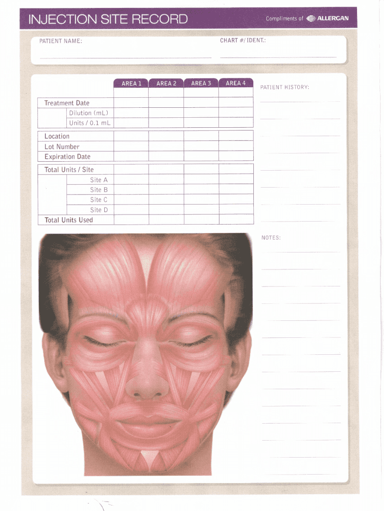Botox Face Diagram Pdf Fill Online Printable Fillable Blank PdfFiller